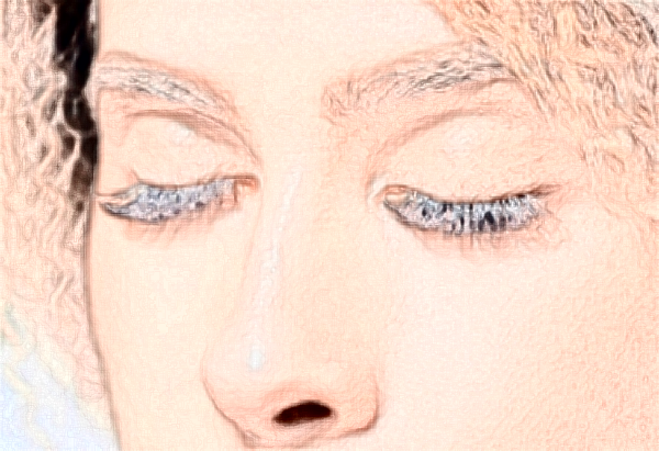 南京2024自體脂肪隆鼻費用多少?自體脂肪隆鼻有什么后遺癥?