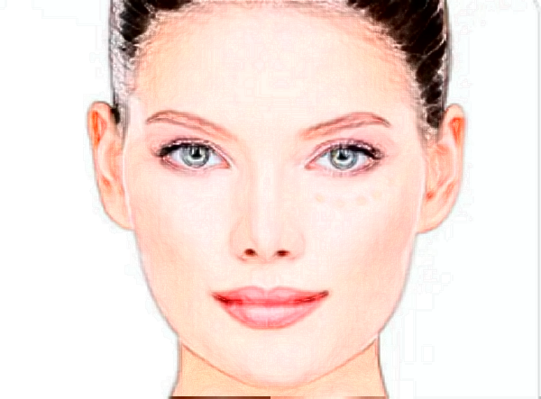 義烏自體脂肪填充面部費用多少?脂肪填充醫(yī)院推薦