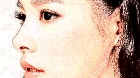 2024鞍鼻矯正價(jià)格表(9月更新)_鞍鼻矯正術(shù)流程