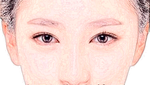 玻尿酸豐太陽穴危險嗎_2024玻尿酸豐太陽穴價格表