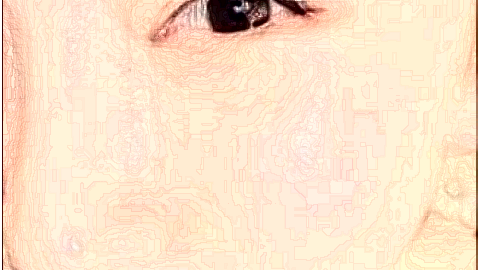 激光祛斑價目表公布_激光祛斑的副作用