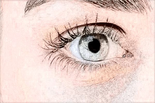 2024開眼角手術(shù)價格表(10月更新)_開眼角會留疤嗎