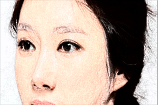 南醫(yī)大友誼面部年輕化收費(fèi)價(jià)格表(價(jià)目表)一覽