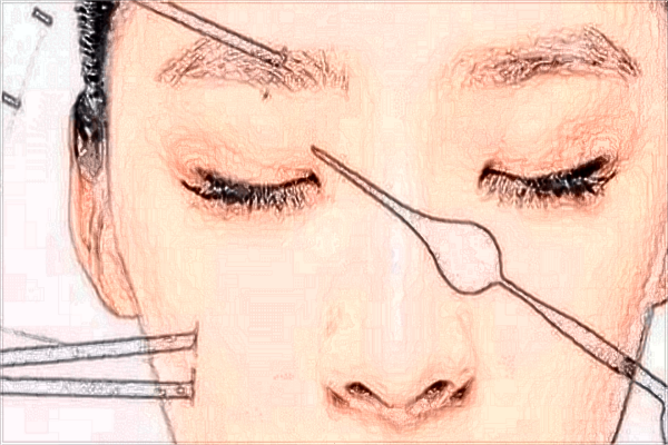 南醫(yī)大友誼面部年輕化收費(fèi)價(jià)格表(價(jià)目表)一覽