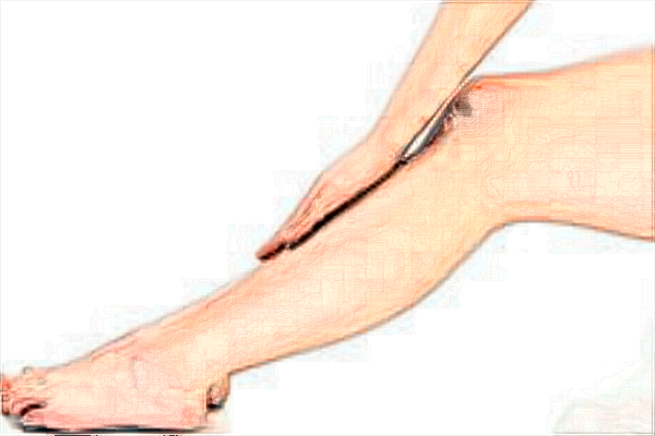 2024常州瘦小腿醫(yī)院哪家好_瘦小腿價目表公布