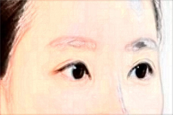 ?？谌パ鄞羌裔t(yī)院好_【附案例】