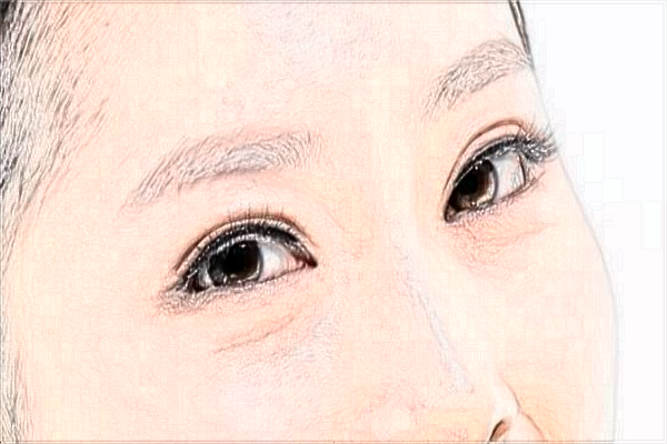 2024?？陔p眼皮醫(yī)院排名_【醫(yī)生推薦】