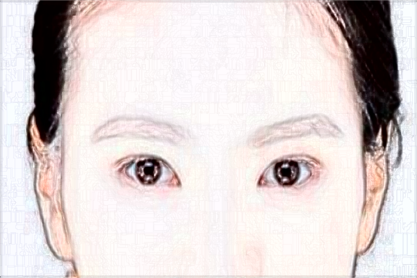 ?？谪S額頭價(jià)目表_醫(yī)院哪里好