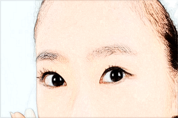 2024價(jià)格表公布_手術(shù)能夠維持幾年