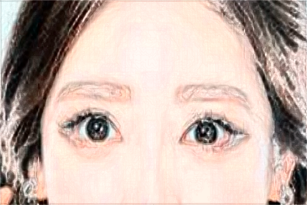 割雙眼皮和埋線(xiàn)哪個(gè)好?割雙眼皮和去眼袋哪個(gè)風(fēng)險(xiǎn)大?