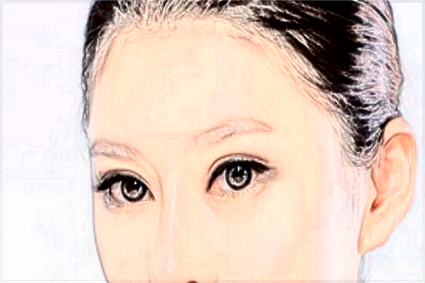 割雙眼皮和埋線(xiàn)哪個(gè)好?割雙眼皮和去眼袋哪個(gè)風(fēng)險(xiǎn)大?