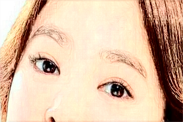 割雙眼皮需要多少錢一次?割雙眼皮需要恢復多長時間?