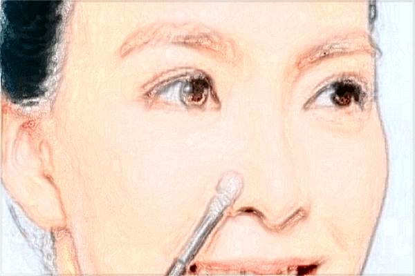 耳垂矯正價(jià)格表_垂耳矯正后還會(huì)垂下來(lái)嗎