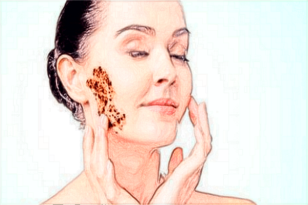 2024上海伯思立祛斑價目表_彩光祛斑好不好