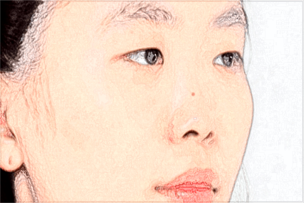 上海伯思立點(diǎn)痣如何?上海伯思立點(diǎn)痣價(jià)目表一覽