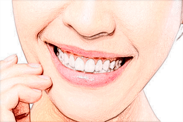 種植牙齒多少錢(qián)一顆_2024種植牙價(jià)目表