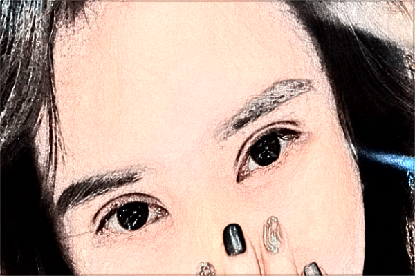 割雙眼皮需要住院嗎?割雙眼皮需要打麻藥嗎?