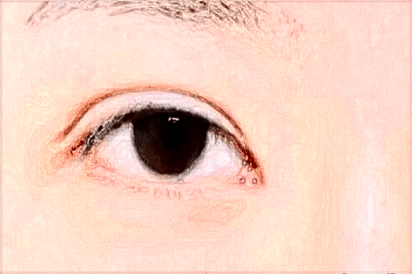 2024北京同仁醫(yī)院做雙眼皮價(jià)格表(價(jià)目表)怎么樣