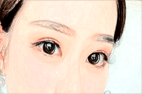 2024濟(jì)南雙眼皮整形醫(yī)院排名_附雙眼皮案例