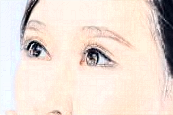 2024煙臺(tái)洛神做眼袋哪位醫(yī)生技術(shù)好_【附眼袋案例】