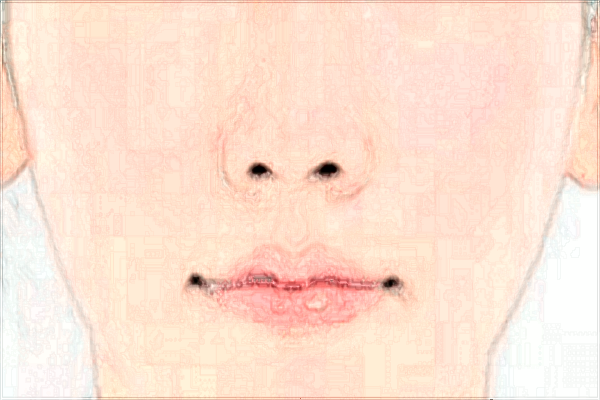 2024濟南隆鼻整形醫(yī)院排行榜_附醫(yī)生名單