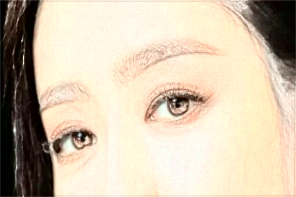 廈門做眼角提升怎么樣?廈門眼角提升價格表公布