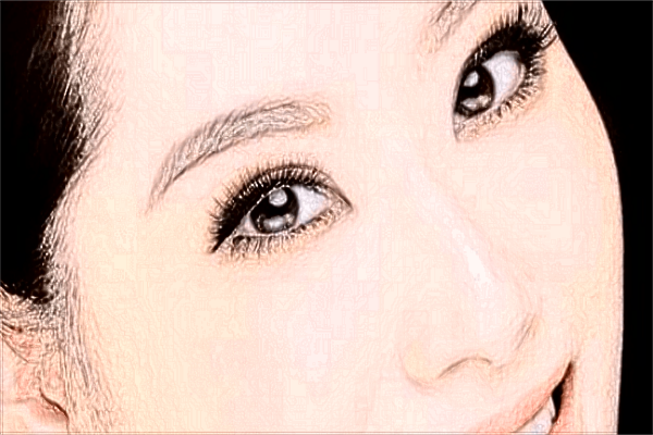 上海伊萊美光子嫩膚怎么樣?光子嫩膚可以皮膚松弛嗎