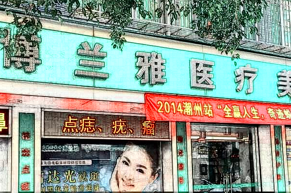 潮州哪里可以做雙眼皮?做的好嗎?