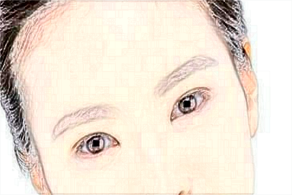 2024北京沃爾整形醫(yī)院雙眼皮價(jià)目表(價(jià)格表)怎么樣