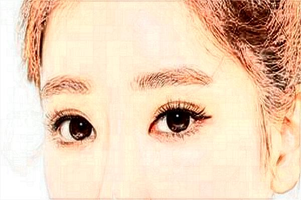 2024北京沃爾整形醫(yī)院雙眼皮價(jià)目表(價(jià)格表)怎么樣