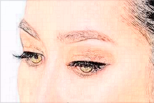 上海時光整形醫(yī)院做提眉怎么樣_提眉術和全切雙眼皮哪個效果好