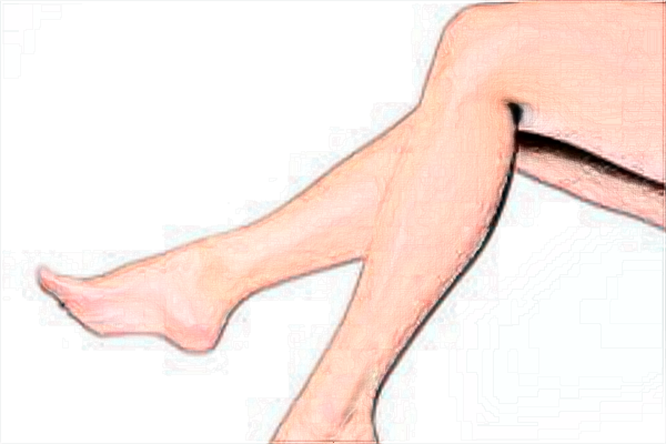 北京協(xié)和醫(yī)院吸脂王陽技術(shù)好不好【吸脂手術(shù)案例】