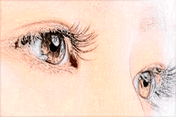 激光去眼袋的價(jià)目表_激光去眼袋的危害和效果