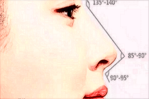 硅膠豐太陽(yáng)穴效果怎么樣?2024硅膠豐太陽(yáng)穴價(jià)格表