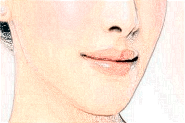 2024寧波市第一醫(yī)院隆鼻整形價(jià)目表