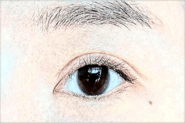 2024北京協(xié)和醫(yī)院開眼角價目表(價格表)怎么樣