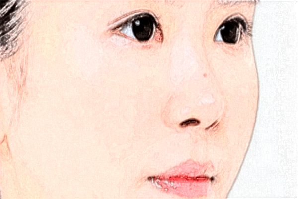 2024重慶聯(lián)合麗格黨寧技術(shù)怎么樣【附手術(shù)案例】