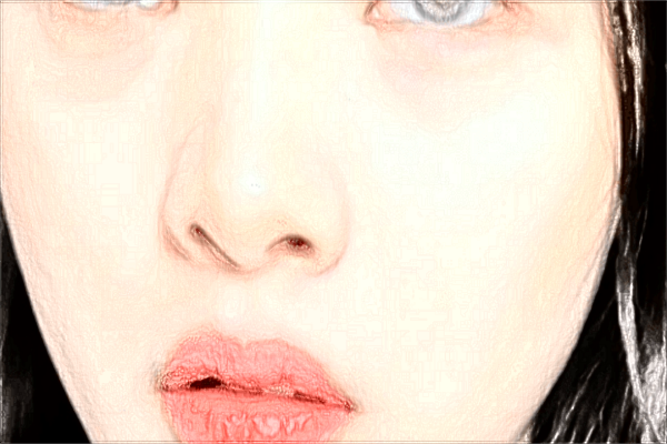 2024潮州華美鼻子哪個醫(yī)生做得好【附案例】