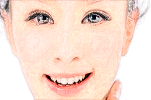 北京中醫(yī)醫(yī)院激光美容價(jià)目表(價(jià)格表)曝光_怎么樣