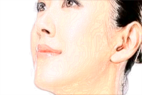 北京中醫(yī)醫(yī)院激光美容價(jià)目表(價(jià)格表)曝光_怎么樣