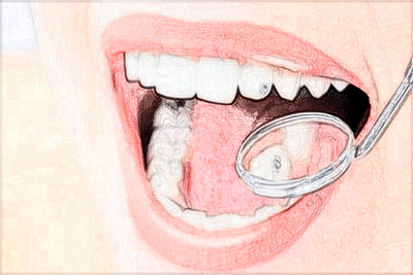 2024北京中醫(yī)醫(yī)院種植牙價目表(價格表)曝光_怎么樣