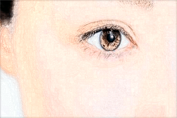 吉林市中心醫(yī)院做雙眼皮多少錢?做雙眼皮好嗎