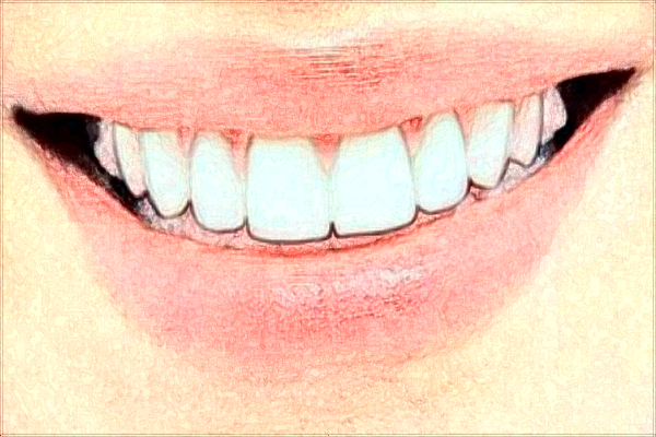 2024上海前牙種植價目表(價格表)曝光_醫(yī)院哪家好