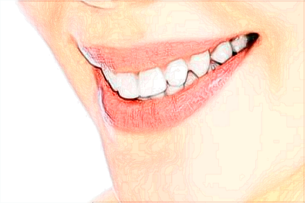 2024上海前牙種植價目表(價格表)曝光_醫(yī)院哪家好