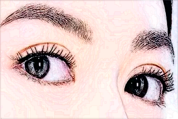 保定割雙眼皮價(jià)目表(價(jià)格表)公布_醫(yī)生名單