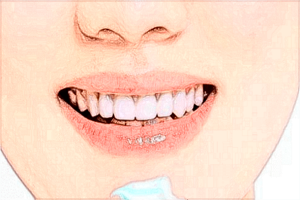 北京中醫(yī)醫(yī)院烤瓷牙補牙多少錢_哪位醫(yī)生技術(shù)比較好