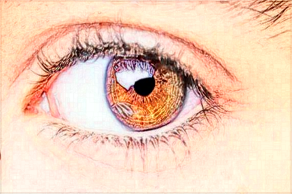 廣州海峽整形醫(yī)院怎么樣?附雙眼皮整形案例