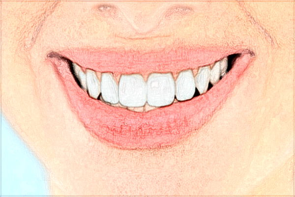 河北醫(yī)科大學(xué)第三醫(yī)院激光脫毛好不好?收費價格是多少