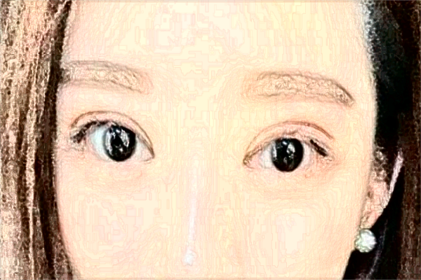 北京藝美脂肪隆鼻價目表(價格表)怎么樣