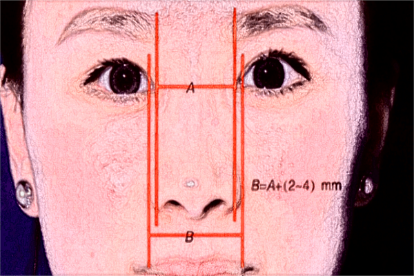 2024做鼻子要花多少錢?做鼻子手術多久可以恢復